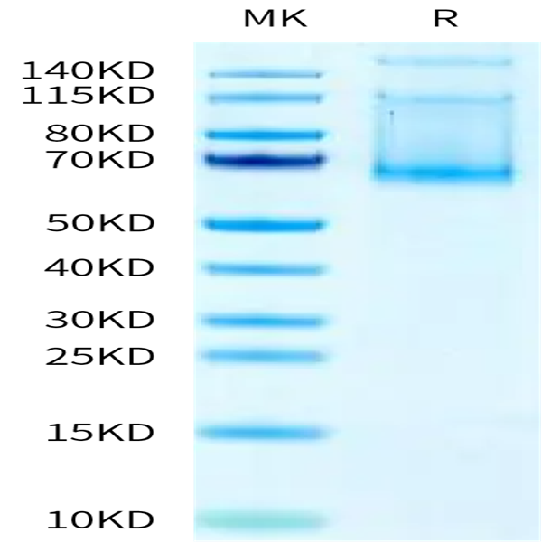 Mouse ADAM9 Protein (ADM-MM109)