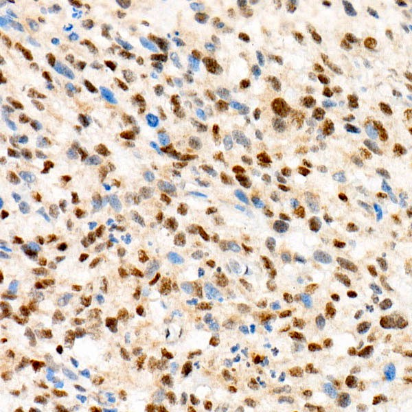 TFE3 Rabbit mAb (Catalog Number: A0548) Abclonal