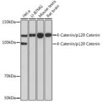 δ-Catenin/p120 Catenin Rabbit mAb (A11399)