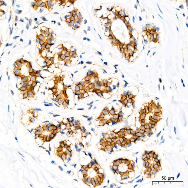 A11399: δ-Catenin/p120 Catenin Rabbit mAb