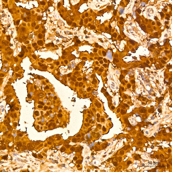 A19061: GST3/GSTP1 Rabbit mAb