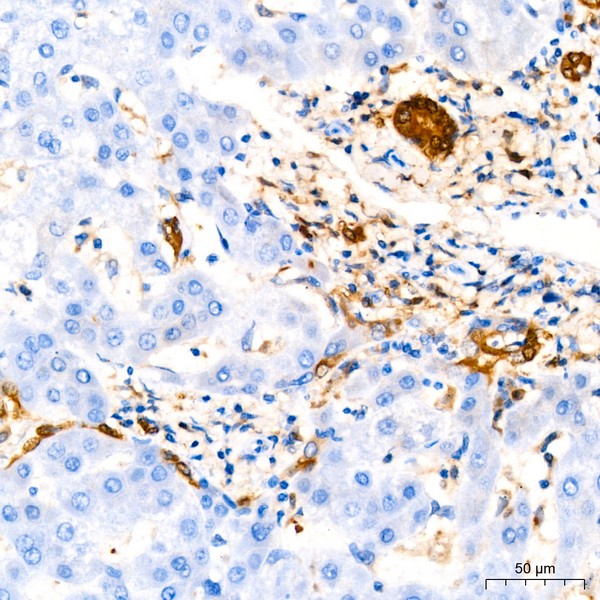 GST3/GSTP1 Rabbit mAb (Catalog Number: A19061) Abclonal