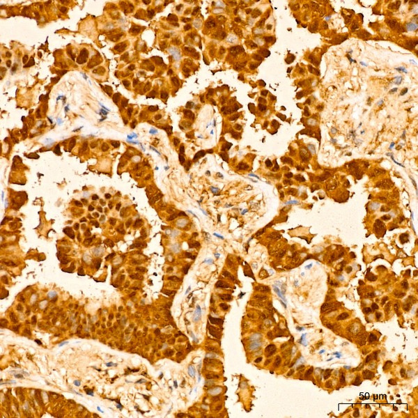 Abclonal GST3/GSTP1 Rabbit mAb (Catalog Number: A19061)