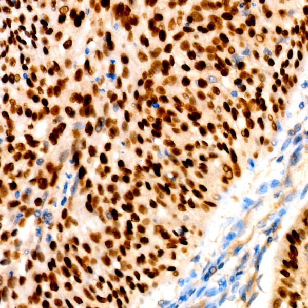 A19652: p63 Rabbit mAb