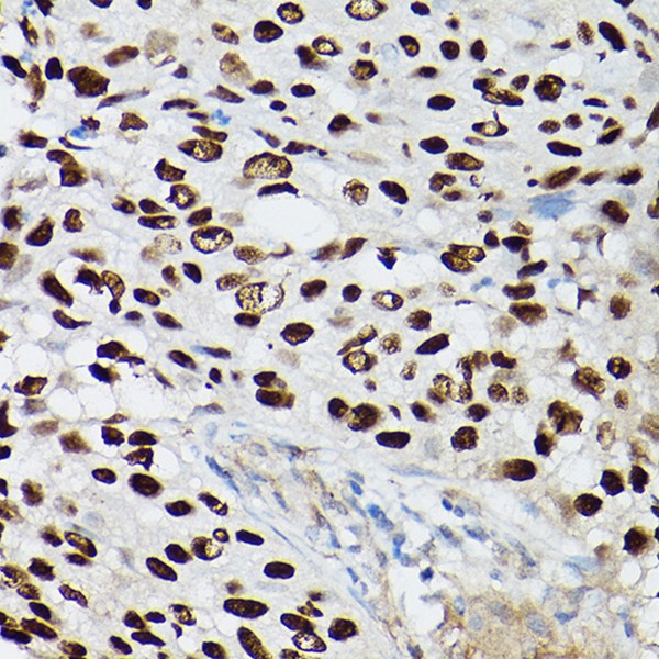 p63 Rabbit mAb (Catalog Number: A19652) Abclonal