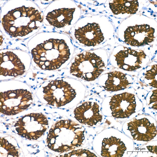 Abclonal Cytokeratin 18 (KRT18) Rabbit mAb (Catalog Number: A19778)