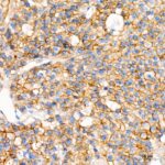 A20221: β-Catenin Mouse mAb