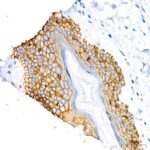 β-Catenin Mouse mAb (Catalog Number: A20221) Abclonal