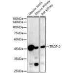 A20824: TROP-2 Rabbit mAb