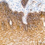 Abclonal TROP-2 Rabbit mAb (Catalog Number: A20824)