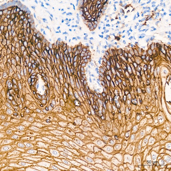 Abclonal TROP-2 Rabbit mAb (Catalog Number: A20824)