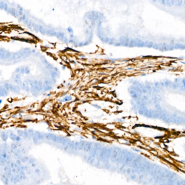 A2235: α-Actin-1 (α-SMA) Rabbit mAb