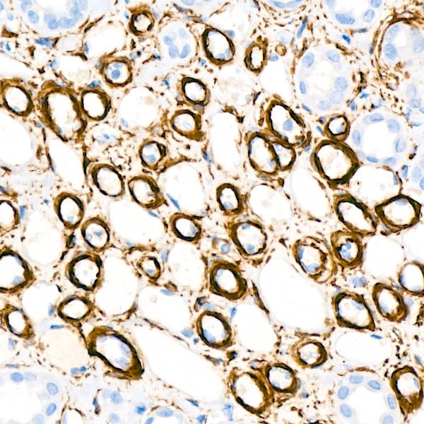 α-Actin-1 (α-SMA) Rabbit mAb (Catalog Number: A2235) Abclonal