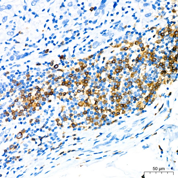 CD79a Rabbit mAb (Catalog Number: A22452)