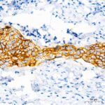 A23248: CD138/Syndecan-1 Rabbit mAb