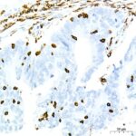 A23503: CD45 Rabbit mAb