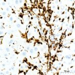 CD45 Rabbit mAb (Catalog Number: A23503) Abclonal