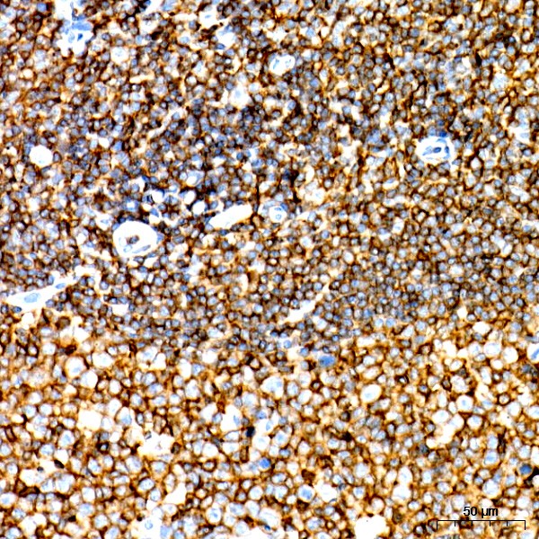 Abclonal CD45 Rabbit mAb (Catalog Number: A23503)