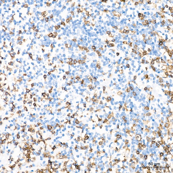 CD3E Rabbit mAb (Catalog Number: A23504) Abclonal