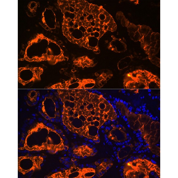 Thyroglobulin Rabbit mAb (Catalog Number: A3407) Abclonal