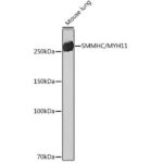 SMMHC/MYH11 Rabbit mAb (A4064)