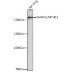 A4064: SMMHC/MYH11 Rabbit mAb