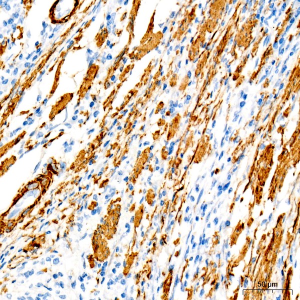 SMMHC/MYH11 Rabbit mAb (Catalog Number: A4064) Abclonal