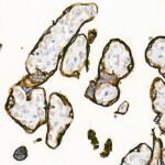 Placental alkaline phosphatase (PLAP) Rabbit mAb (Catalog Number: A4304) Abclonal