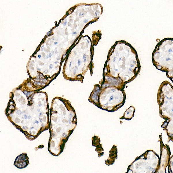 Placental alkaline phosphatase (PLAP) Rabbit mAb (Catalog Number: A4304) Abclonal