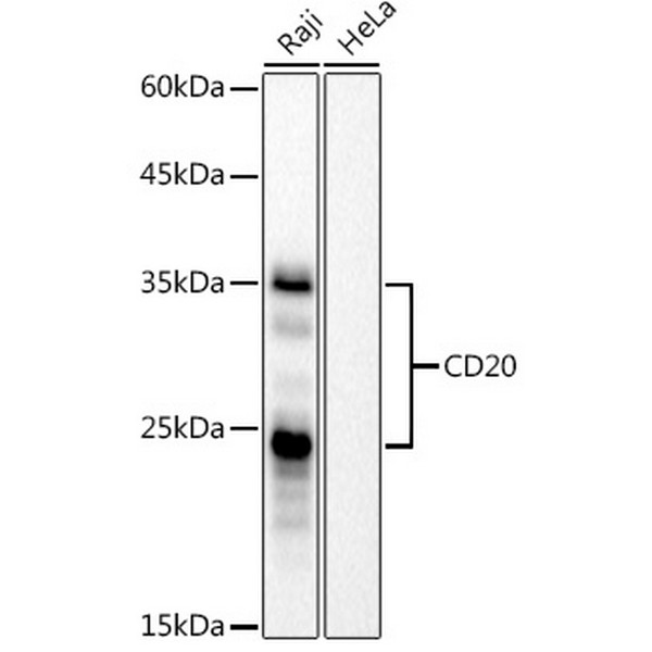 A4893: CD20 Rabbit mAb