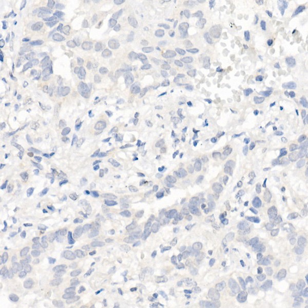 A5031: EGFR (L858R) Rabbit mAb