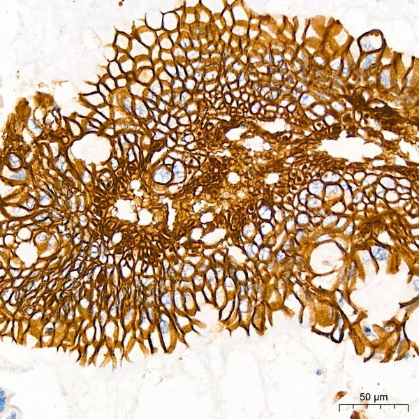 LI Cadherin/Cadherin-17 Rabbit mAb (Catalog Number: A5286) Abclonal