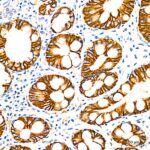 Abclonal LI Cadherin/Cadherin-17 Rabbit mAb (Catalog Number: A5286)
