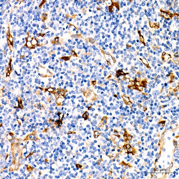 A9566: Fascin/FSCN1 Rabbit mAb