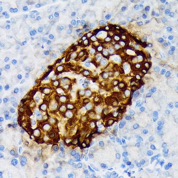 A9576: Chromogranin A Rabbit mAb