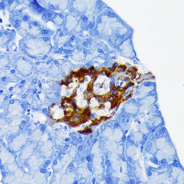 Abclonal Chromogranin A Rabbit mAb (Catalog Number: A9576)