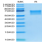Human TPBG/5T4 Protein (5T4-HM401)