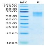 FITC-Labeled Human TPBG/5T4 Protein BP004934 Syd Labs