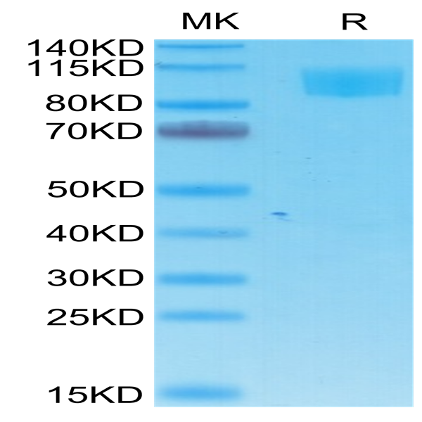 Cynomolgus ACE2/ACEH Protein (ACE-CM401)