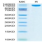 Human ACE2/ACEH Protein (ACE-HM201)