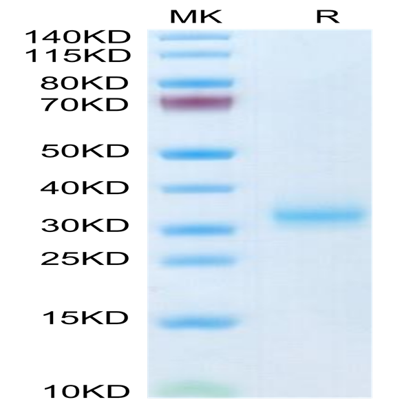 Mouse Adiponectin/Acrp30 Protein (ADI-MM101)