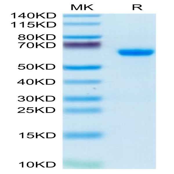 Human ADAM8 Protein (ADM-HM108)