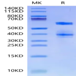 Mouse ADAM8 Protein (ADM-MM108)
