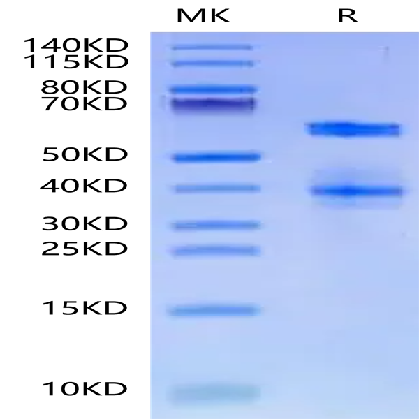 Mouse ADAM8 Protein (ADM-MM108)