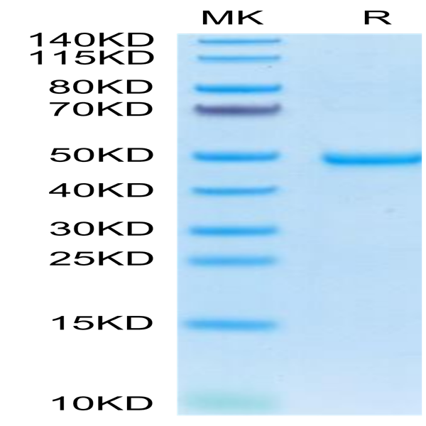 Human AREG Protein (AEG-HM201)