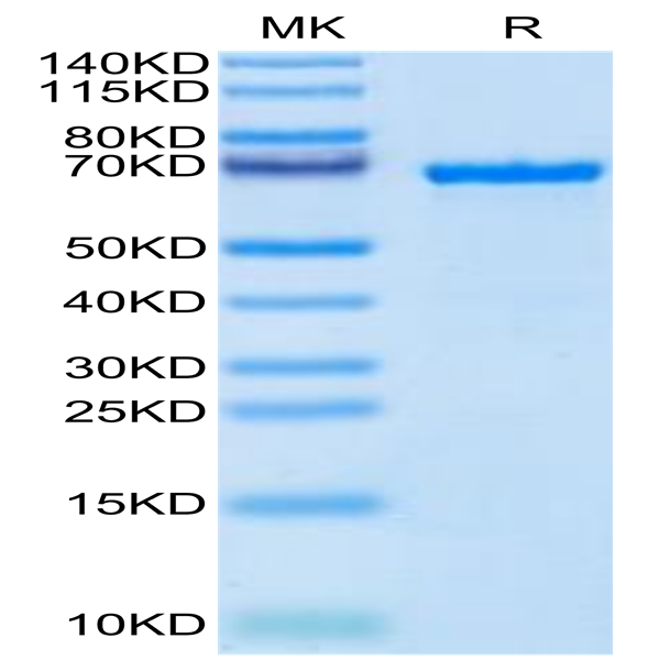 Cynomolgus AFP Protein (AFP-CM101)