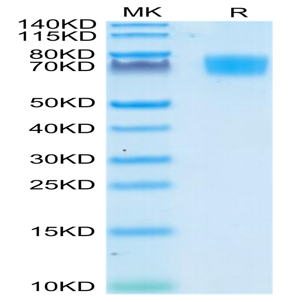 Human ALCAM/CD166 Protein (ALC-HM101)