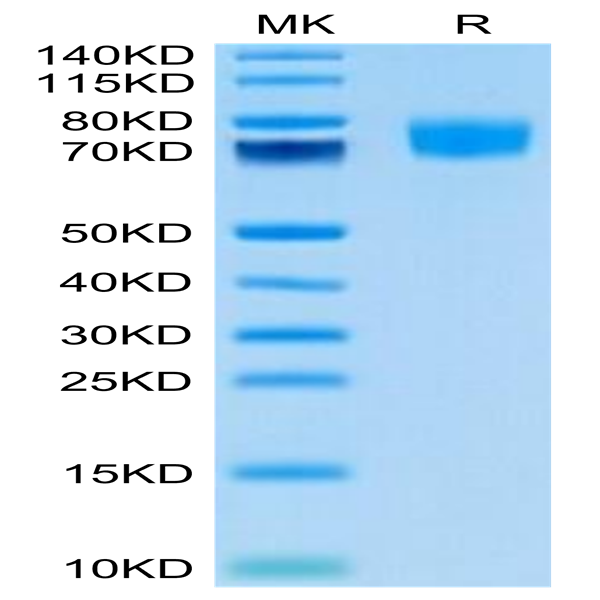 Biotinylated Human ALCAM/CD166 Protein (Primary Amine Labeling) (ALC-HM101B)