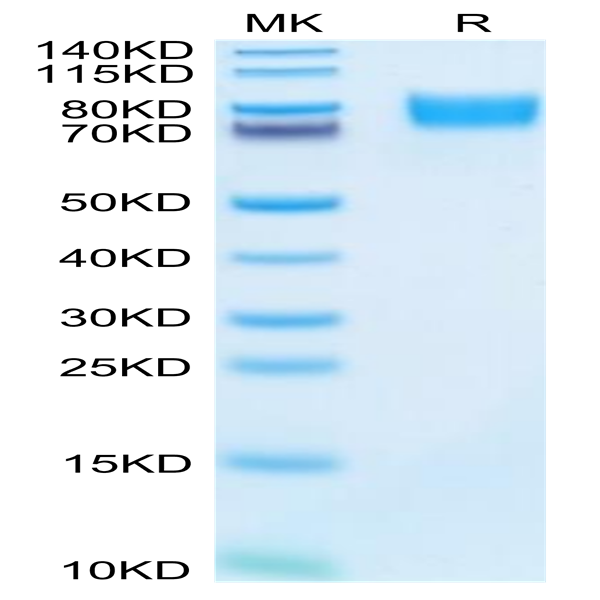 Mouse ALCAM/CD166 Protein (ALC-MM101)