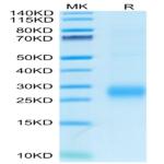 Human ALK-1/ACVRL1 Protein (ALK-HM101)